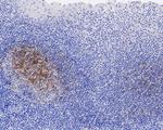 CXCL13 Antibody in Immunohistochemistry (Paraffin) (IHC (P))