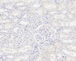 CXCL13 Antibody in Immunohistochemistry (Paraffin) (IHC (P))