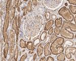 Acid Phosphatase 1 Antibody in Immunohistochemistry (Paraffin) (IHC (P))