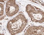 Acid Phosphatase 1 Antibody in Immunohistochemistry (Paraffin) (IHC (P))