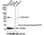 Acid Phosphatase 1 Antibody in Western Blot (WB)