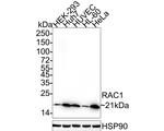 RAC1 Antibody in Western Blot (WB)