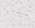 CUGBP1 Antibody in Immunohistochemistry (Paraffin) (IHC (P))