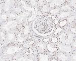 CUGBP1 Antibody in Immunohistochemistry (Paraffin) (IHC (P))