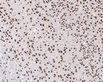 CUGBP1 Antibody in Immunohistochemistry (Paraffin) (IHC (P))