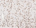 CUGBP1 Antibody in Immunohistochemistry (Paraffin) (IHC (P))