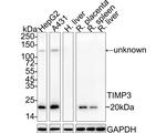 TIMP3 Antibody in Western Blot (WB)