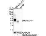 TNFRSF14 Recombinant Rabbit Monoclonal Antibody (PSH05-56)