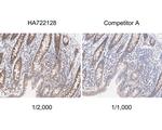 TXNDC9 Antibody in Immunohistochemistry (Paraffin) (IHC (P))