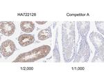 TXNDC9 Antibody in Immunohistochemistry (Paraffin) (IHC (P))
