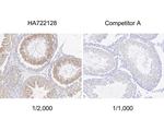 TXNDC9 Antibody in Immunohistochemistry (Paraffin) (IHC (P))