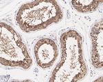 TXNDC9 Antibody in Immunohistochemistry (Paraffin) (IHC (P))