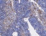 PD-L1 Antibody in Immunohistochemistry (Paraffin) (IHC (P))