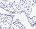 PD-L1 Antibody in Immunohistochemistry (Paraffin) (IHC (P))