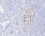 Nkx2.2 Antibody in Immunohistochemistry (Paraffin) (IHC (P))