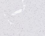 Nkx2.2 Antibody in Immunohistochemistry (Paraffin) (IHC (P))