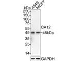 Carbonic Anhydrase XII Antibody in Western Blot (WB)