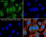 BRCC3 Antibody in Immunocytochemistry (ICC/IF)