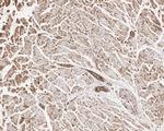 BRCC3 Antibody in Immunohistochemistry (Paraffin) (IHC (P))