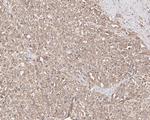 BRCC3 Antibody in Immunohistochemistry (Paraffin) (IHC (P))