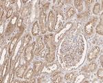 BRCC3 Antibody in Immunohistochemistry (Paraffin) (IHC (P))