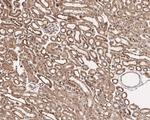 BRCC3 Antibody in Immunohistochemistry (Paraffin) (IHC (P))