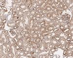 BRCC3 Antibody in Immunohistochemistry (Paraffin) (IHC (P))