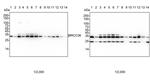 BRCC3 Antibody in Western Blot (WB)