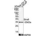 STRA8 Antibody in Western Blot (WB)