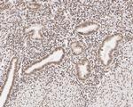 hnRNP AB Antibody in Immunohistochemistry (Paraffin) (IHC (P))