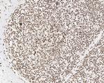 hnRNP AB Antibody in Immunohistochemistry (Paraffin) (IHC (P))