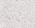 hnRNP AB Antibody in Immunohistochemistry (Paraffin) (IHC (P))