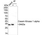 CK1 alpha Antibody in Immunoprecipitation (IP)