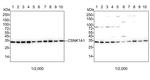 CK1 alpha Antibody in Western Blot (WB)