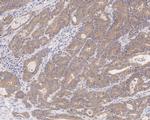 CSNK1A1/CSNK1A1L Antibody in Immunohistochemistry (Paraffin) (IHC (P))