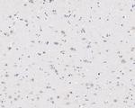CSNK1A1/CSNK1A1L Antibody in Immunohistochemistry (Paraffin) (IHC (P))