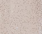 CSNK1A1/CSNK1A1L Antibody in Immunohistochemistry (Paraffin) (IHC (P))