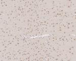 CSNK1A1/CSNK1A1L Antibody in Immunohistochemistry (Paraffin) (IHC (P))