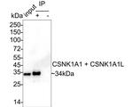 CSNK1A1/CSNK1A1L Antibody in Immunoprecipitation (IP)