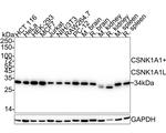 CSNK1A1/CSNK1A1L Antibody in Western Blot (WB)