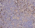 SEC24A Antibody in Immunohistochemistry (Paraffin) (IHC (P))