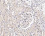 SAV1 Antibody in Immunohistochemistry (Paraffin) (IHC (P))