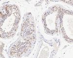 SAV1 Antibody in Immunohistochemistry (Paraffin) (IHC (P))