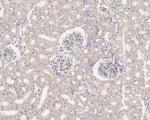 SAV1 Antibody in Immunohistochemistry (Paraffin) (IHC (P))