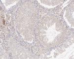 SAV1 Antibody in Immunohistochemistry (Paraffin) (IHC (P))