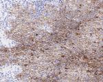 CD30 Antibody in Immunohistochemistry (Paraffin) (IHC (P))