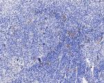 CD30 Antibody in Immunohistochemistry (Paraffin) (IHC (P))