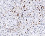 CD30 Antibody in Immunohistochemistry (Paraffin) (IHC (P))