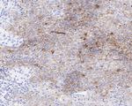 CD30 Antibody in Immunohistochemistry (Paraffin) (IHC (P))