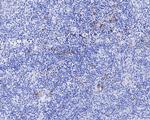 CD30 Antibody in Immunohistochemistry (Paraffin) (IHC (P))